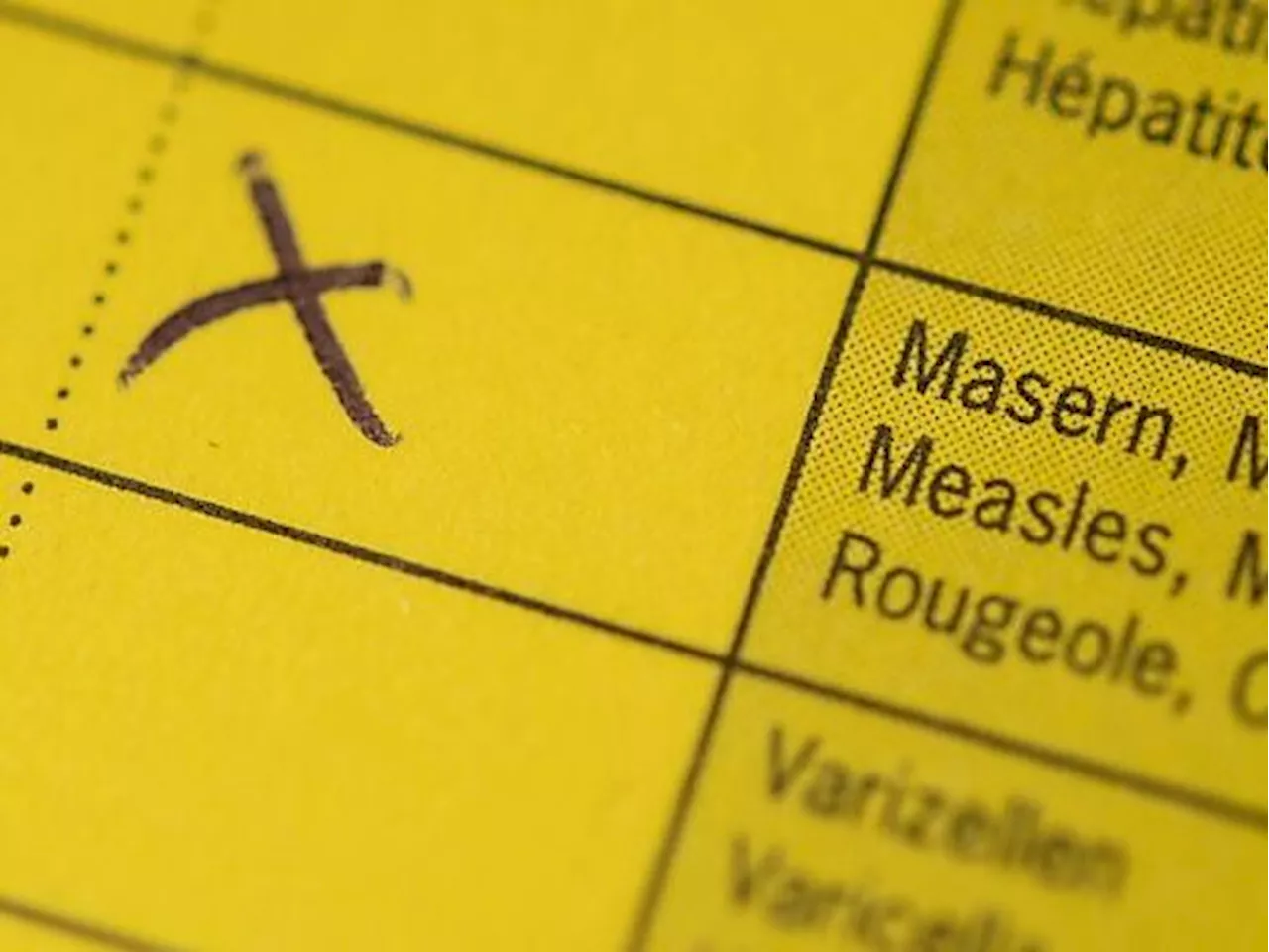 Viele Masernfälle in Deutschland - weltweiter Trend