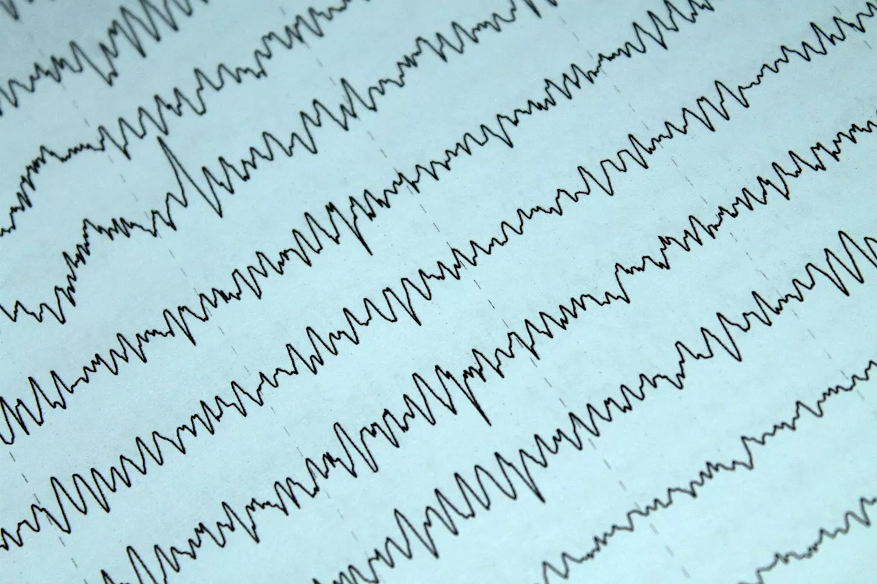 EEG testing shows possible biomarker for suicidal ideation