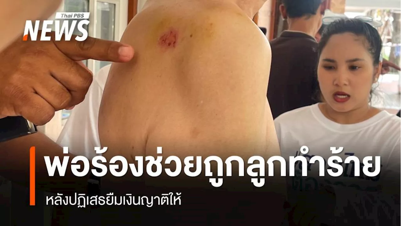 เพจสายไหมต้องรอด เข้าช่วยพ่อวัย 64 ปี ถูกลูกชายทำร่างกาย