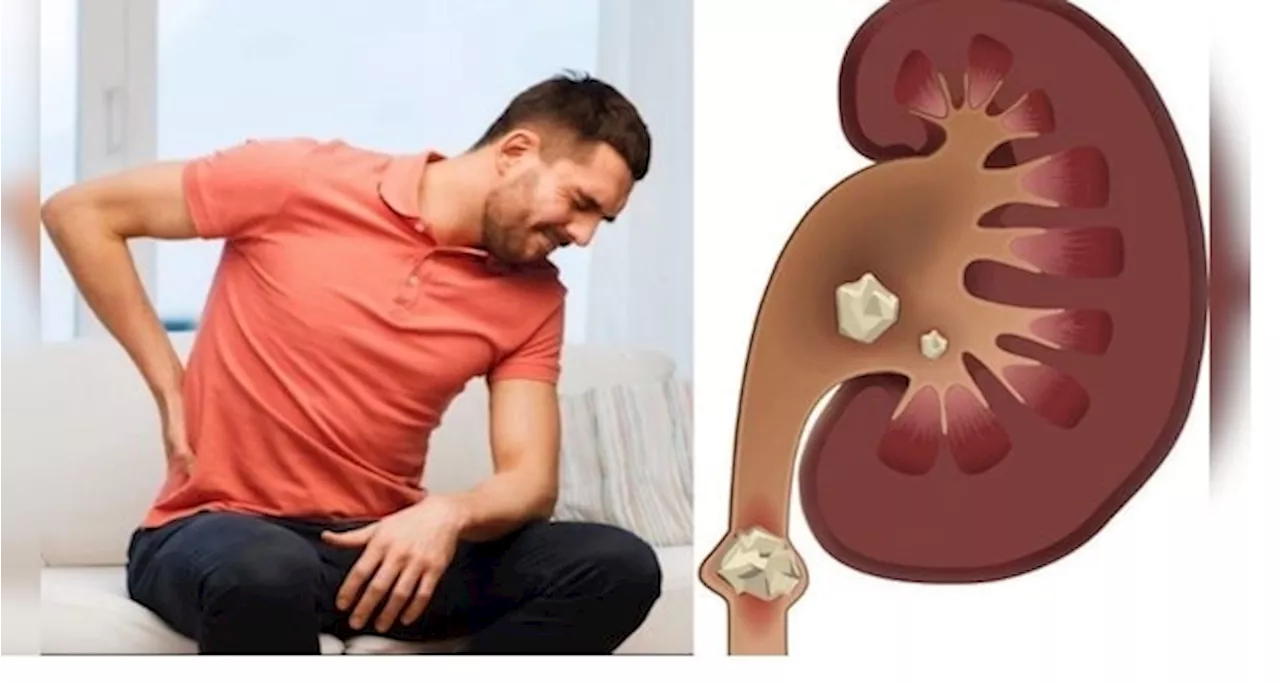 Kidney Stones: కిడ్నీలో రాళ్లు ఎలా ఏర్పడతాయి, ఎలా తొలగించుకోవచ్చు