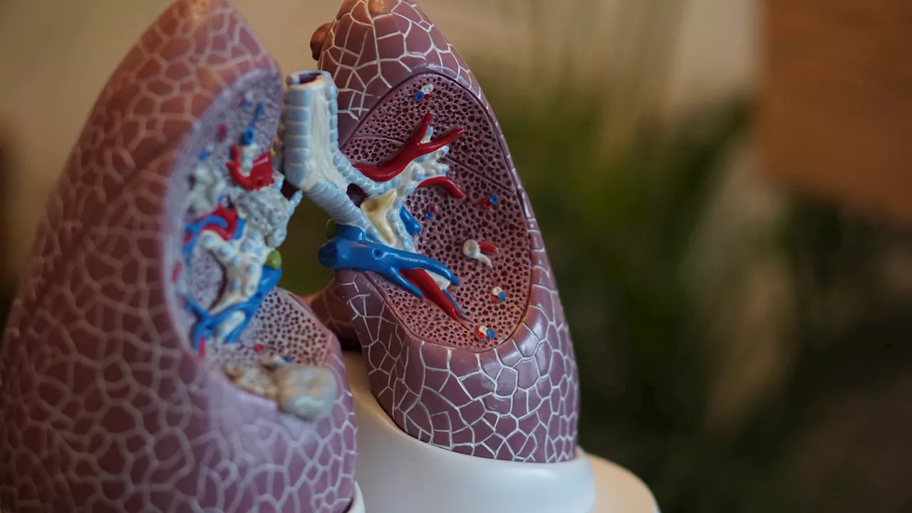 GP Access Crucial for Lung Cancer Survival in New Zealand