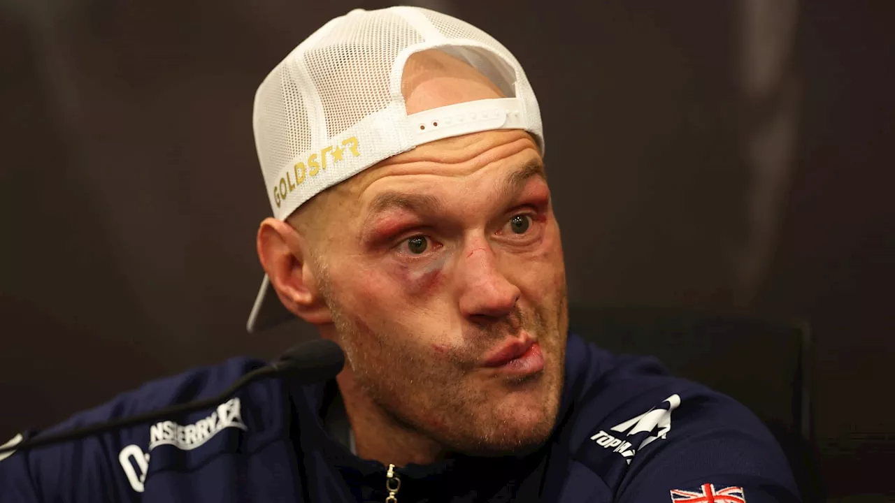 Boxen: Kampf zwischen Tyson Fury und Anthony Joshua in Planung!