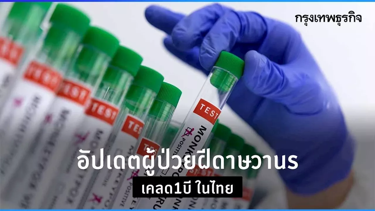 อาการล่าสุด ผู้ป่วย “ฝีดาษวานร เคลด1บี” รายแรกในไทย ก่อนครบ 21 วัน