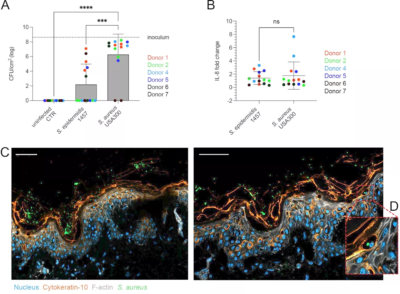 How human skin differentiates bacterial friend from foe