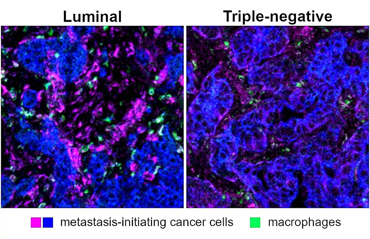 Scientists identify potential new immune system target to head off the spread of breast cancer cells