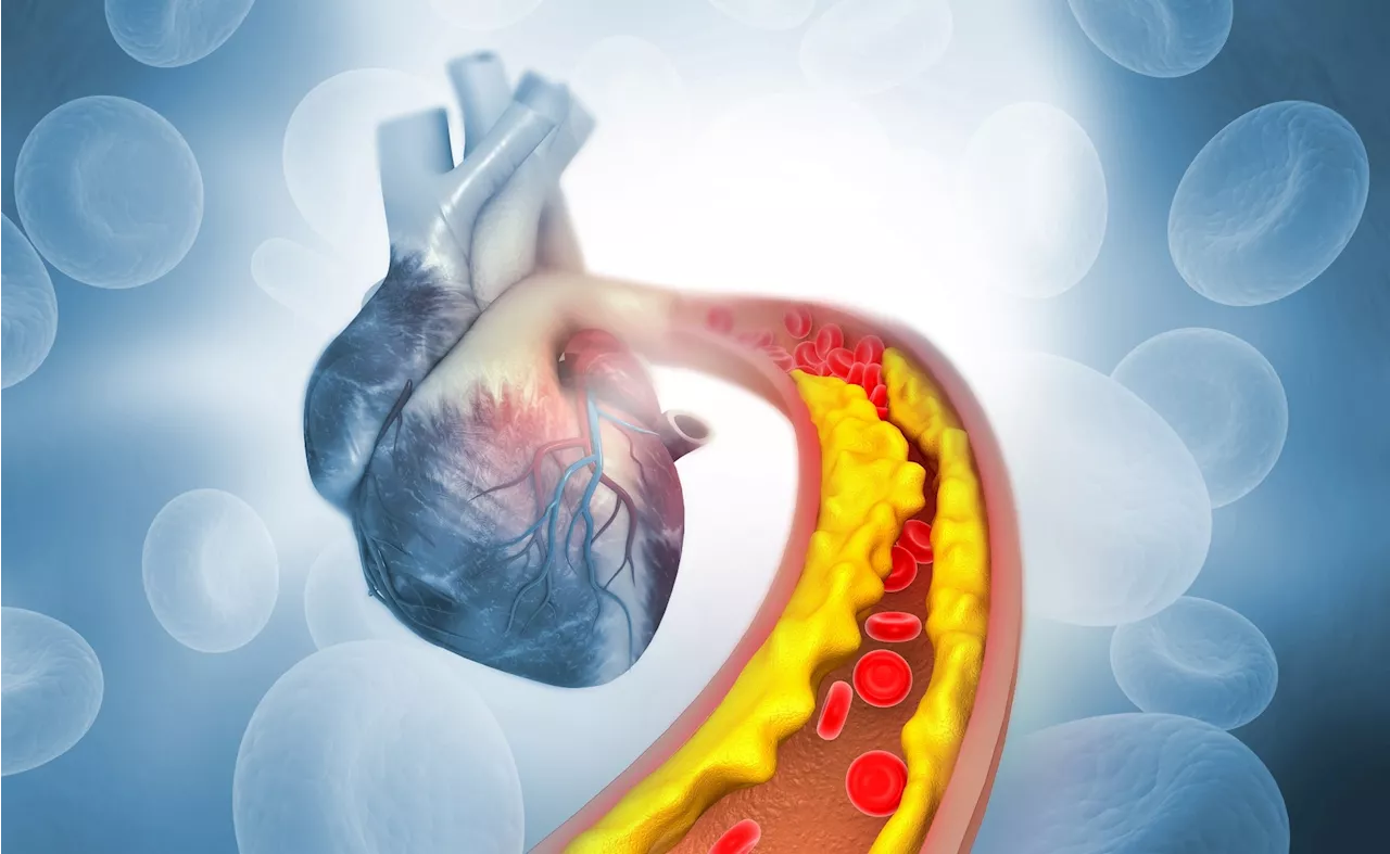 Clonal hematopoiesis drives femoral atherosclerosis in middle-aged adults