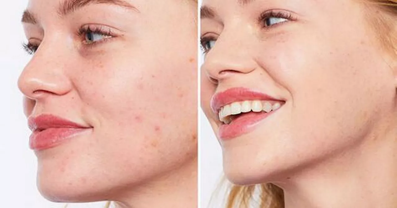 Beauty lovers find incredible anti-redness cream that ‘replaces foundation’