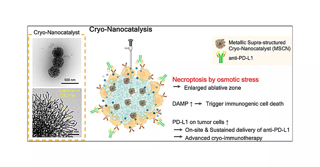 Improving next-generation cancer treatments with cryoimmunotherapy