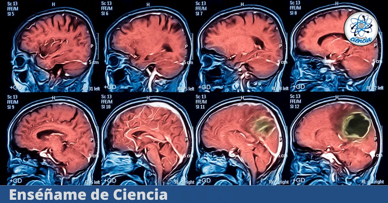 Descubierta la «reserva» cerebral capaz de prevenir el envejecimiento prematuro y la demencia