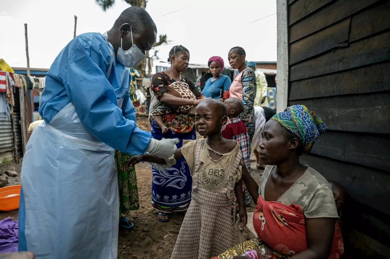 Democratic Republic of Congo expects first delivery of mpox vaccine doses on Thursday