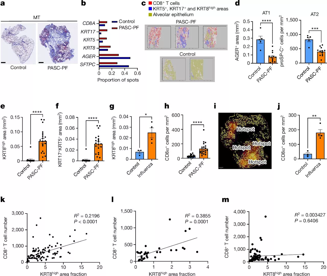 Immune pathways can prevent lung healing after viral infection, study shows