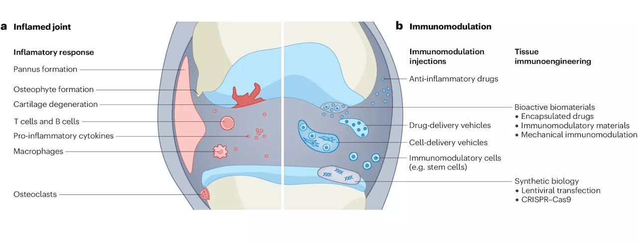 Researchers advocate for tissue-engineering approach for arthritis relief