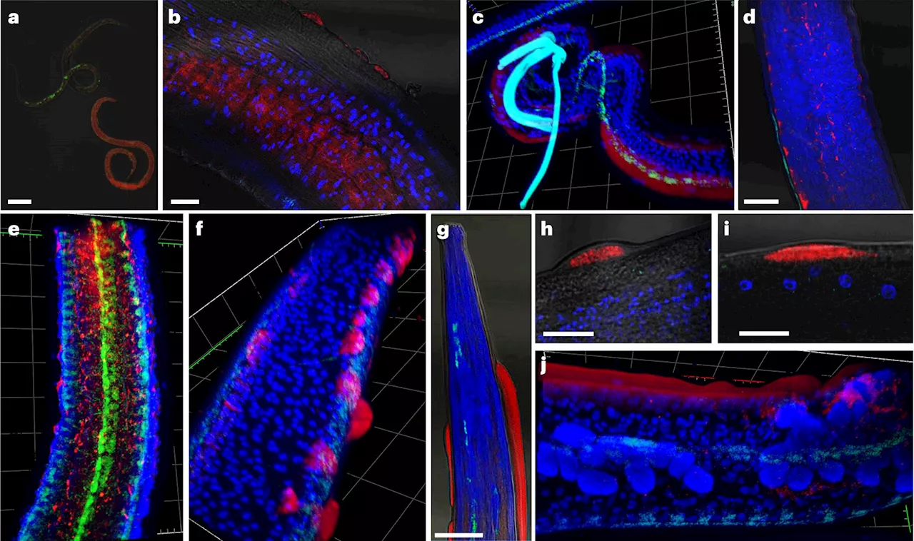 Newly discovered viruses in parasitic nematodes could change our understanding of how they cause disease