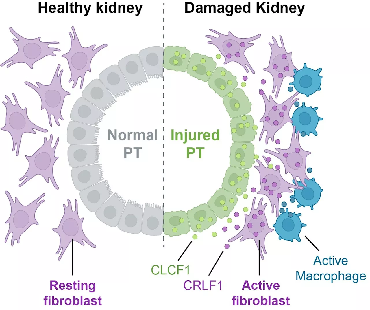 New study shows cells get involved in unhealthy relationships after acute kidney injury in mice