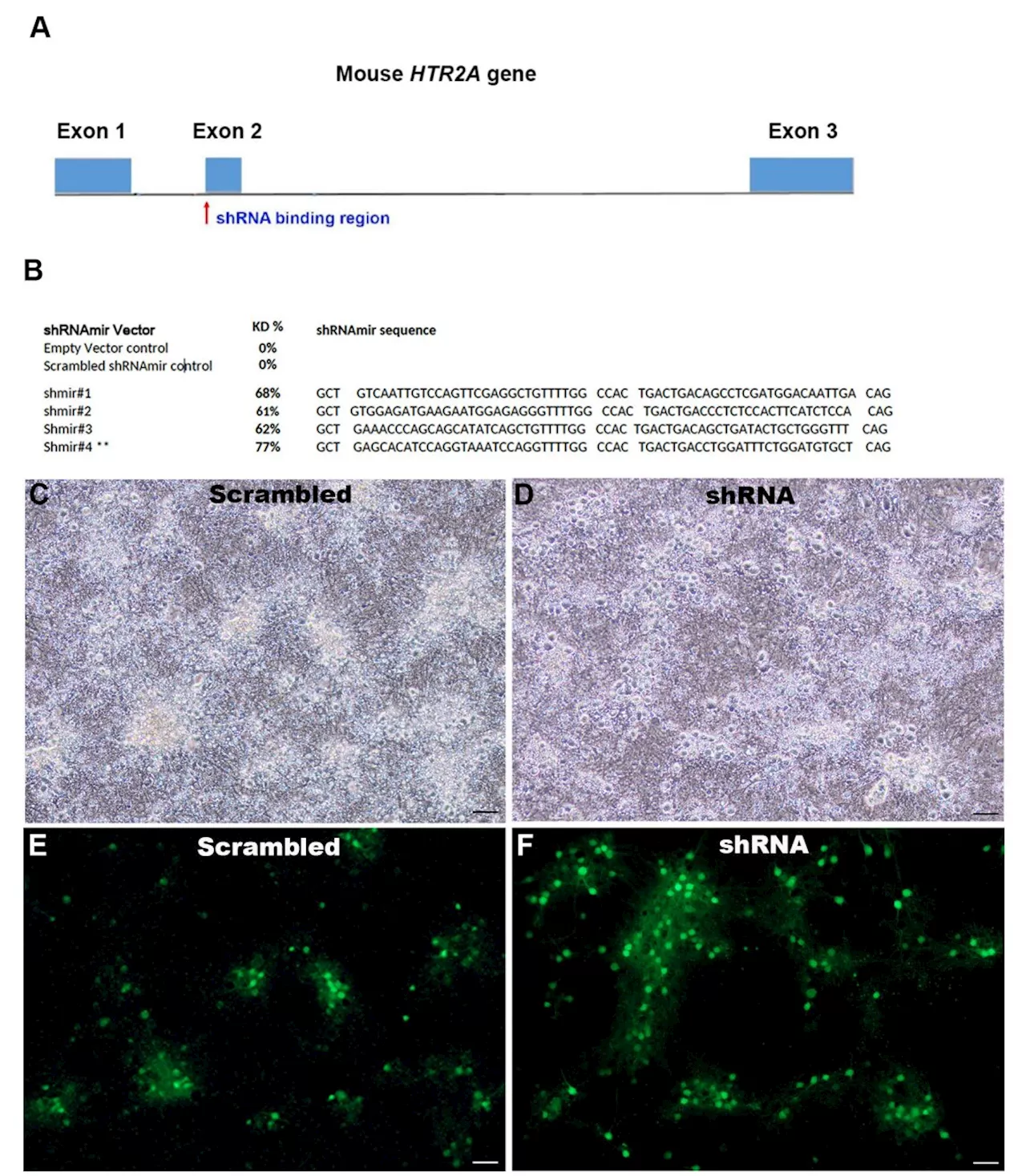 RNA treatment shows promise for enhancing memory and reducing anxiety