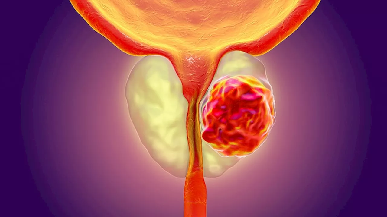 Androgen Receptor Pathway Inhibitors Show Improved Outcomes in Prostate Cancer