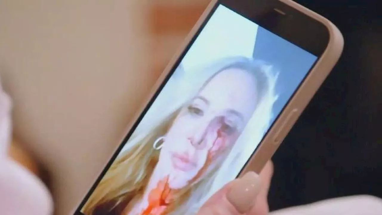 Real Housewives Of Orange County: Shannon Beador shares bloody selfie from DUI crash and reveals...