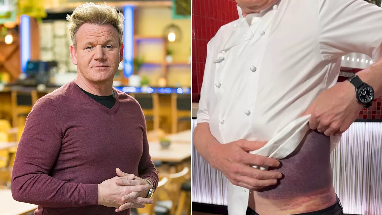 Gordon Ramsay describes bike accident that left him bloodied with blurred vision