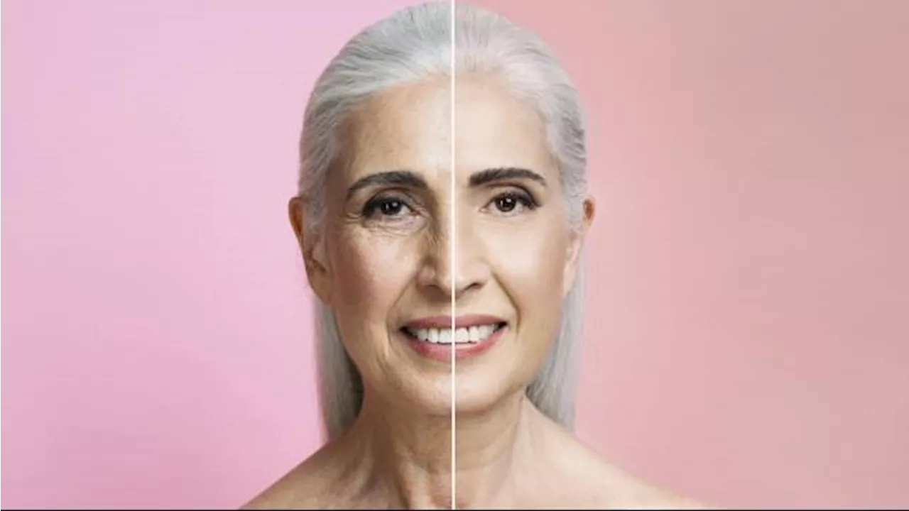 5 Masalah Kesehatan yang Dapat Diatasi dengan Botox