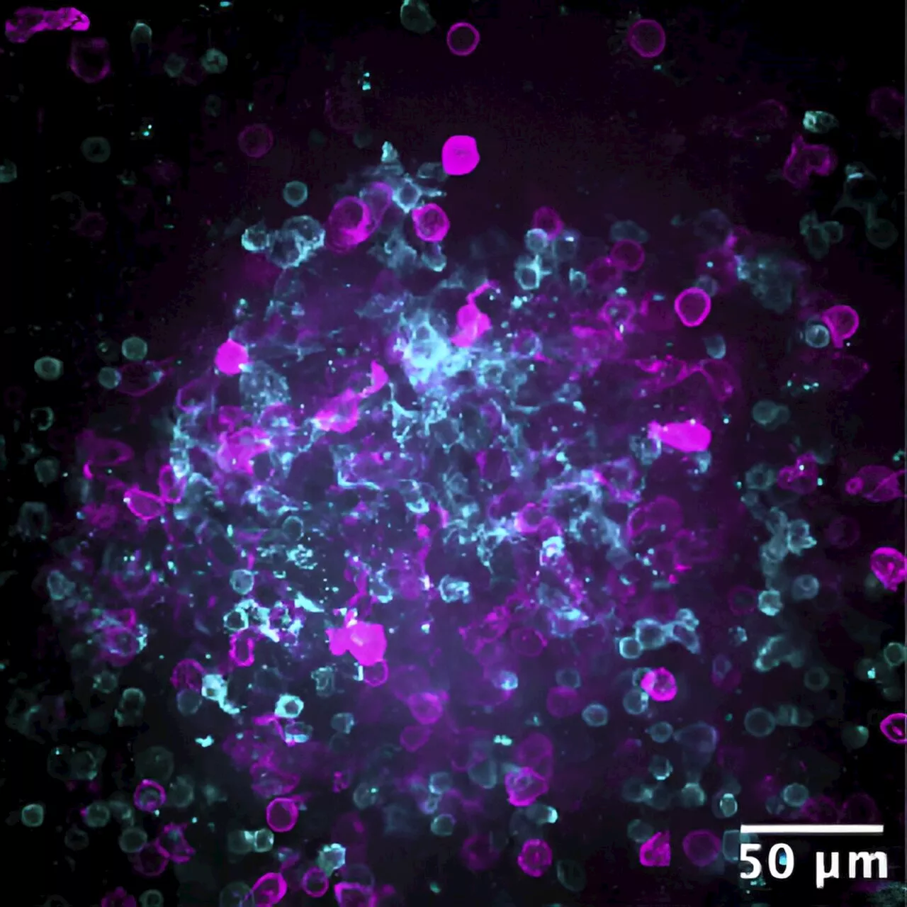 Artificial lymphoid organs could help predict efficacy of booster vaccines
