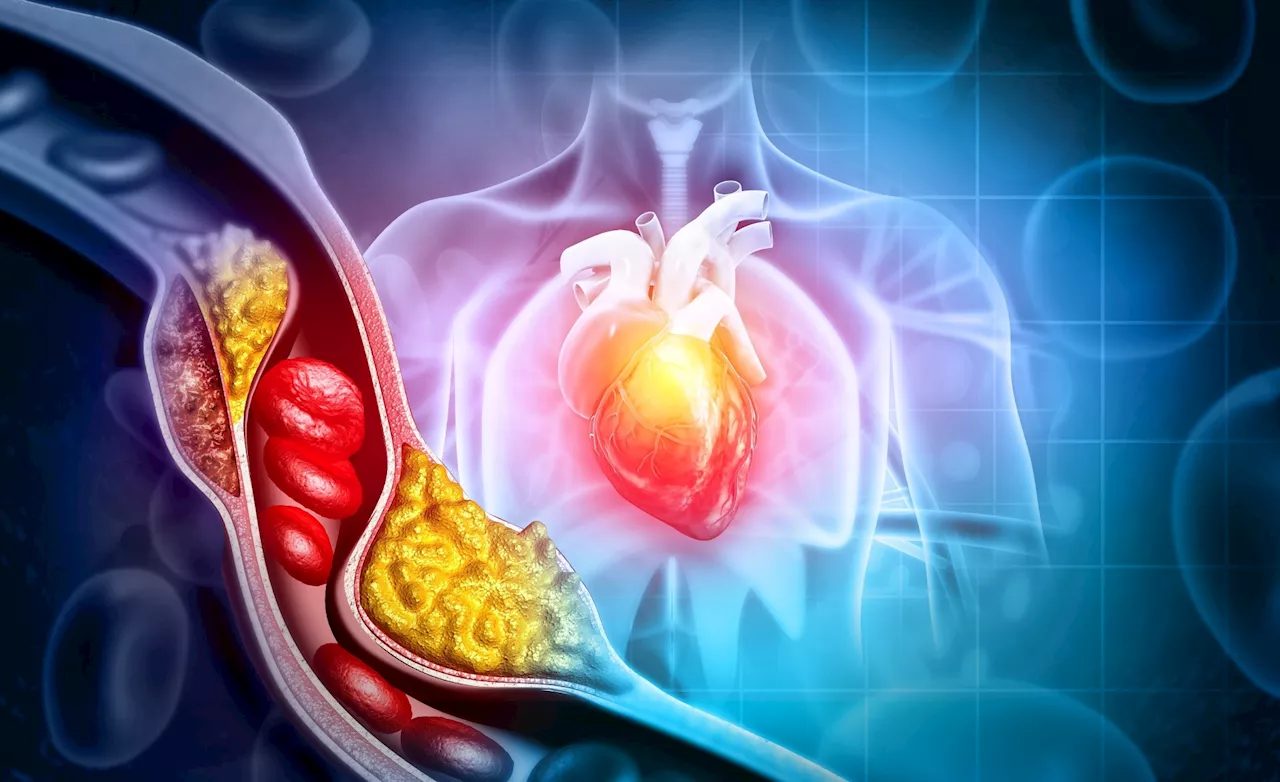 Early cholesterol spikes fuel atherosclerosis by altering macrophages