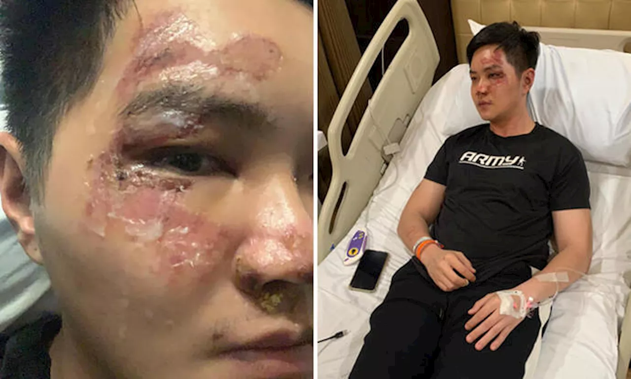 Man says he was pushed down stairs and beaten after night out drinking in MacPherson