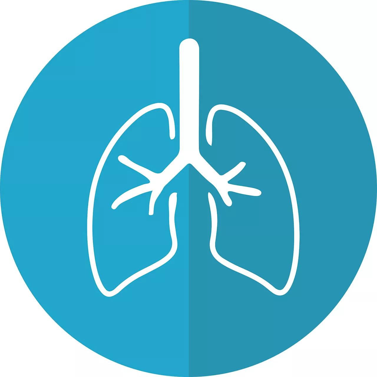 Perioperative nivolumab may bolster survival over only neoadjuvant nivolumab plus chemotherapy for resectable NSCLC