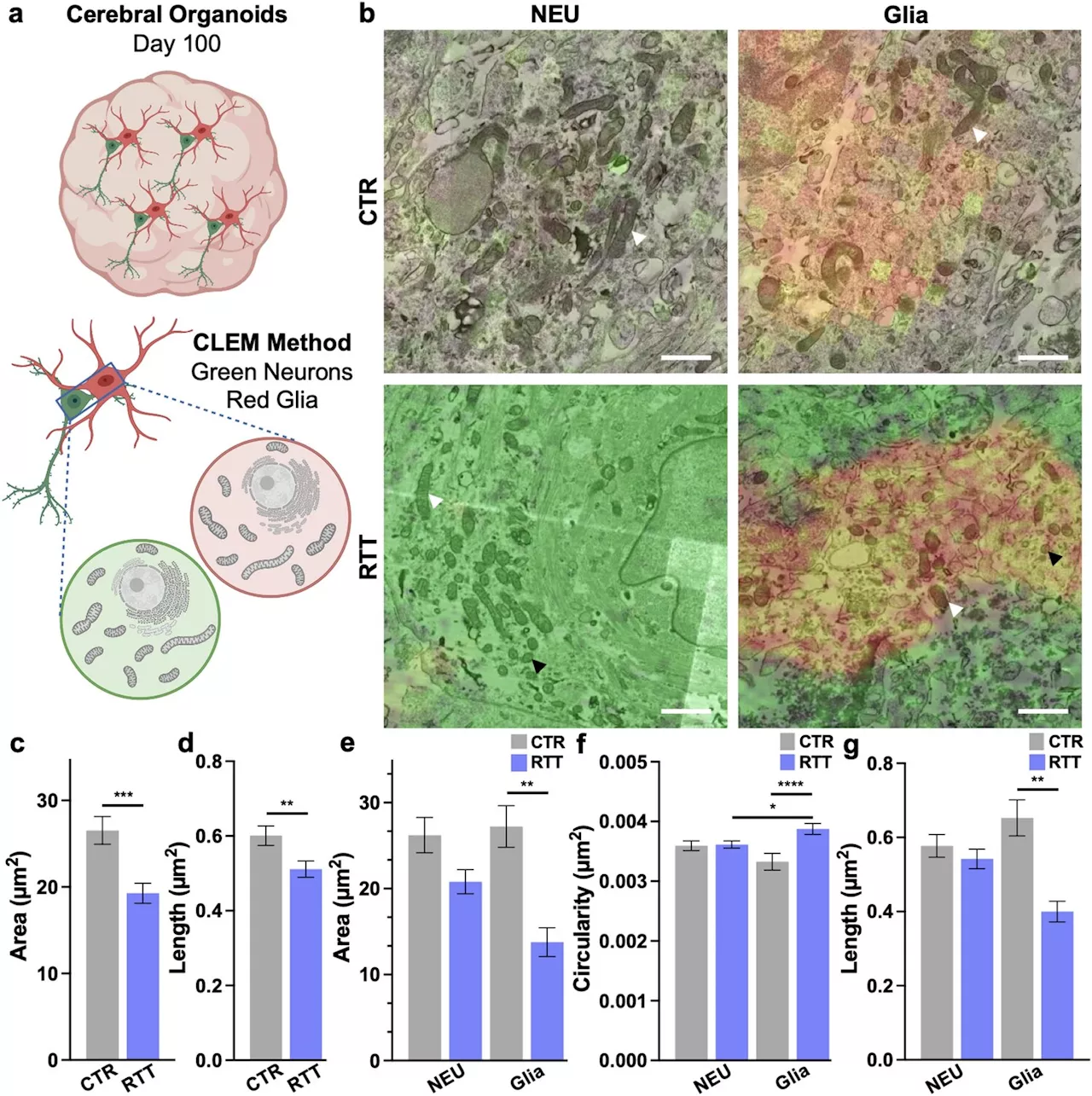 Brain cell types are affected differently by Rett syndrome mutation, researchers discover