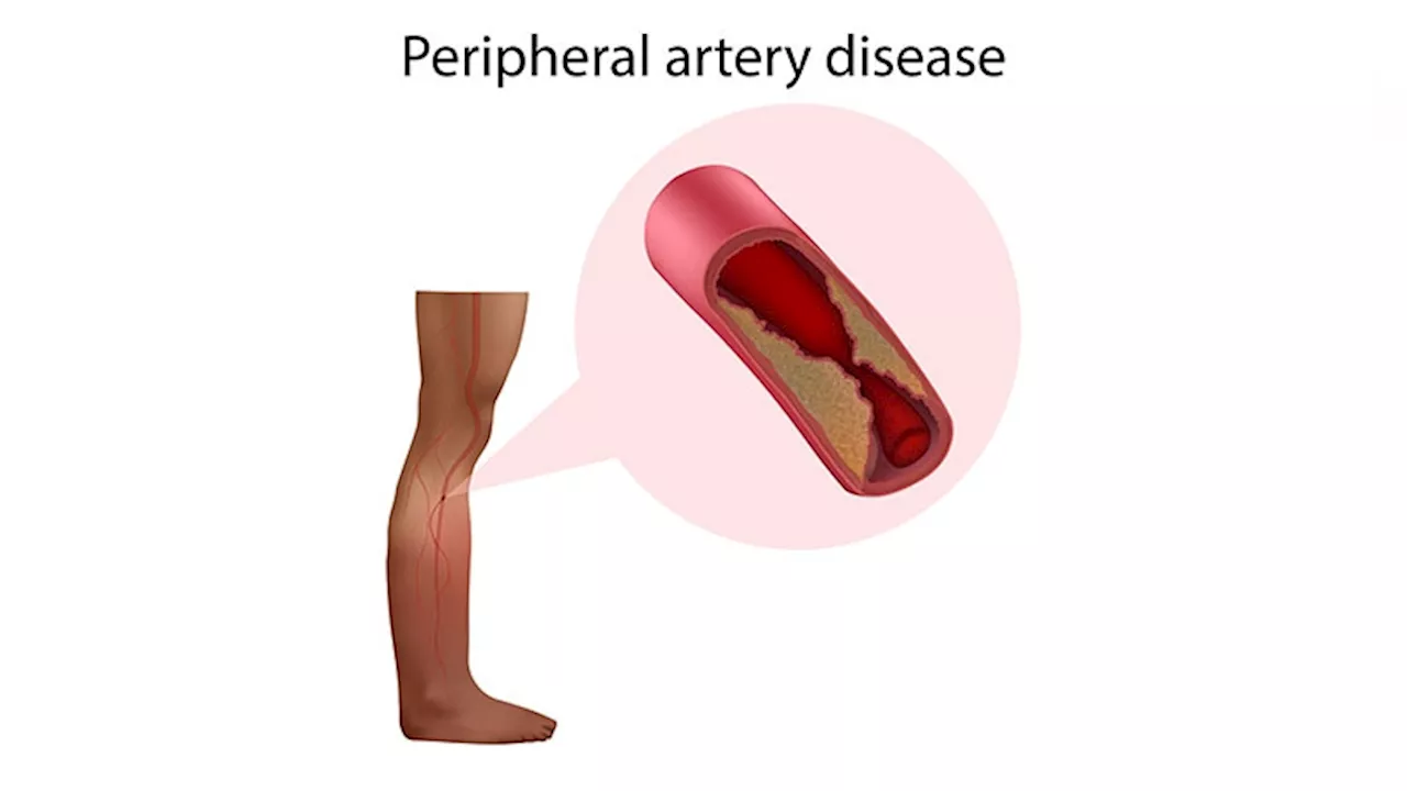 Vascular and Cardiac Collaboration Essential…So Is AI