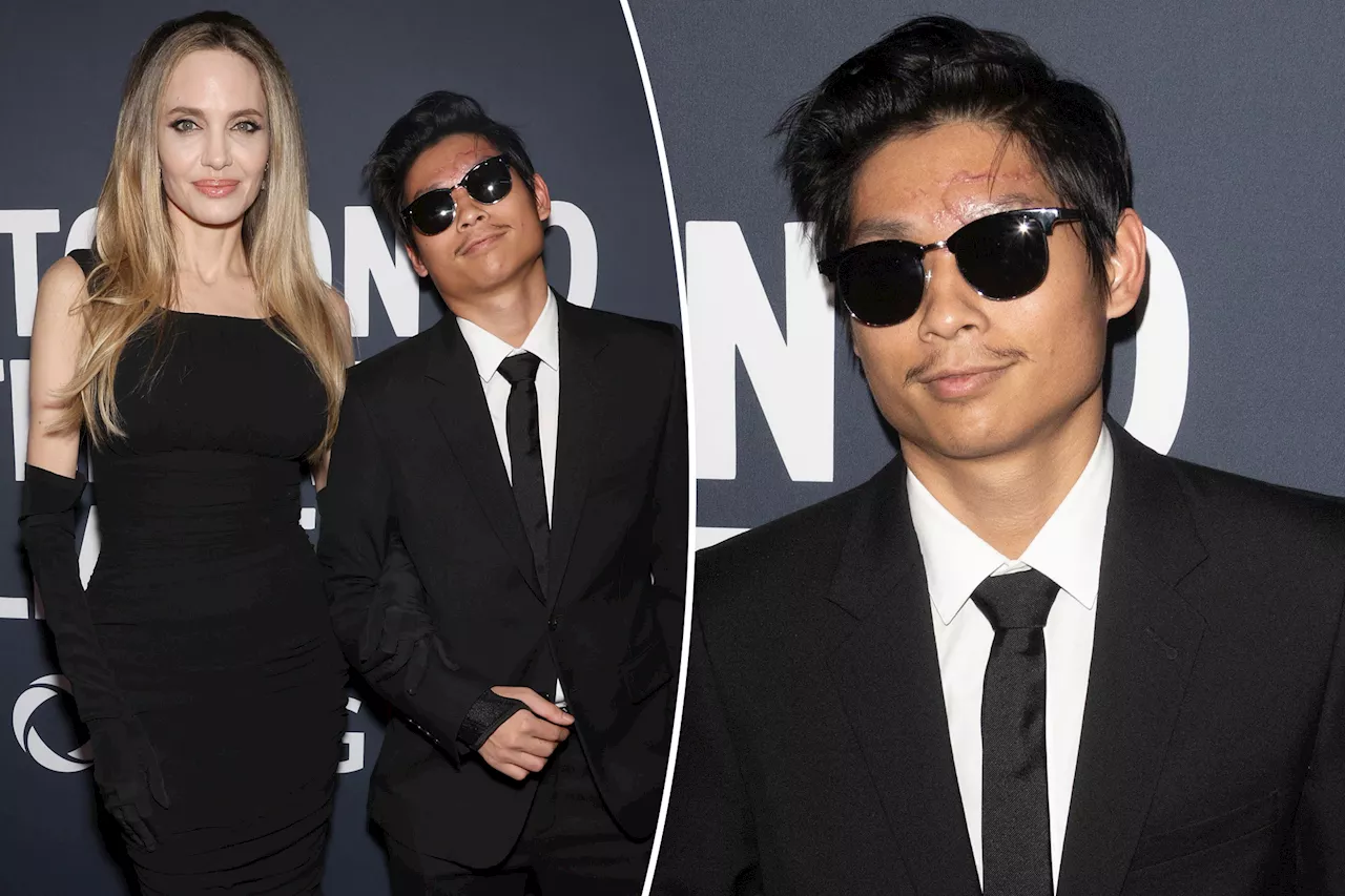 Angelina Jolie's son Pax reveals forehead scar on TIFF red carpet after e-bike crash