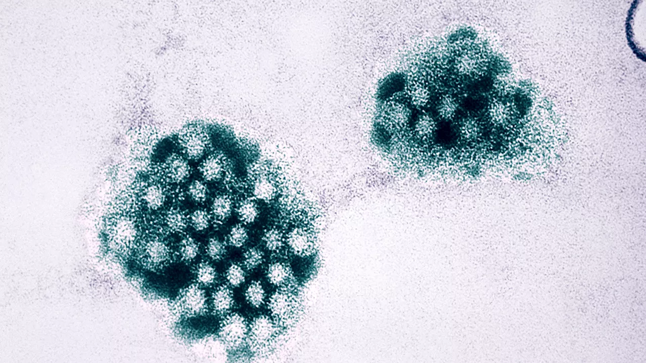 Norovirus Outbreaks Surge Nationally