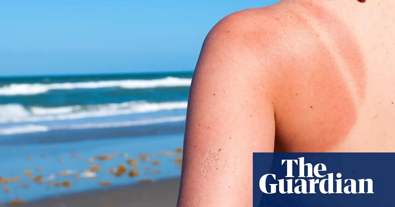 – so why are tan lines having their time in the sun on social media?