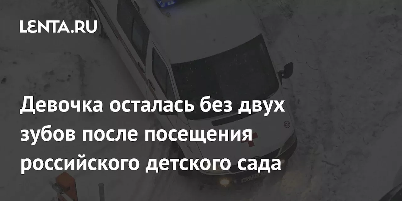 Девочка осталась без двух зубов после посещения российского детского сада