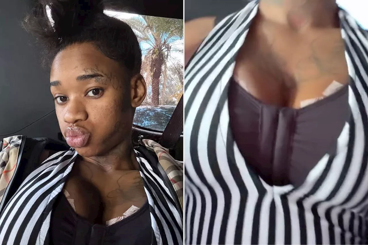 Rapper Sexyy Red Shows Off Results of Latest Breast Augmentation After Saying She Was 'Going Back Big'