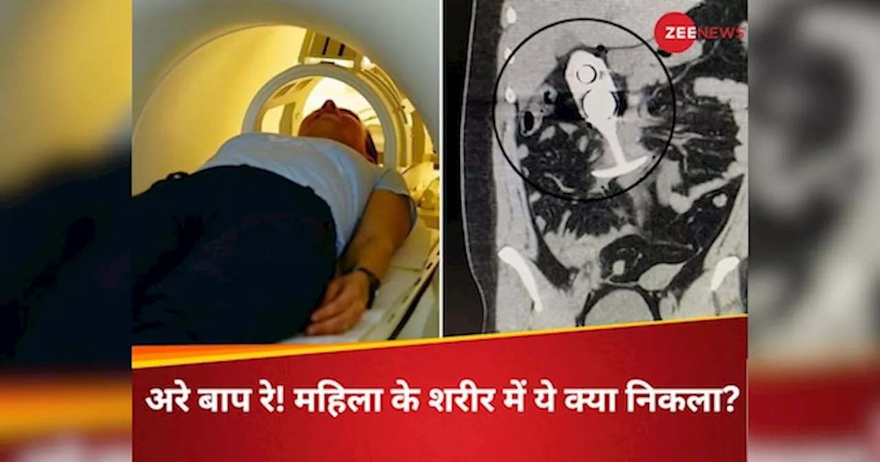 तेज दर्द से टूट रहा था शरीर, महिला का MRI देख डॉक्टरों के उड़े होश, फिर यूं बचाई जान