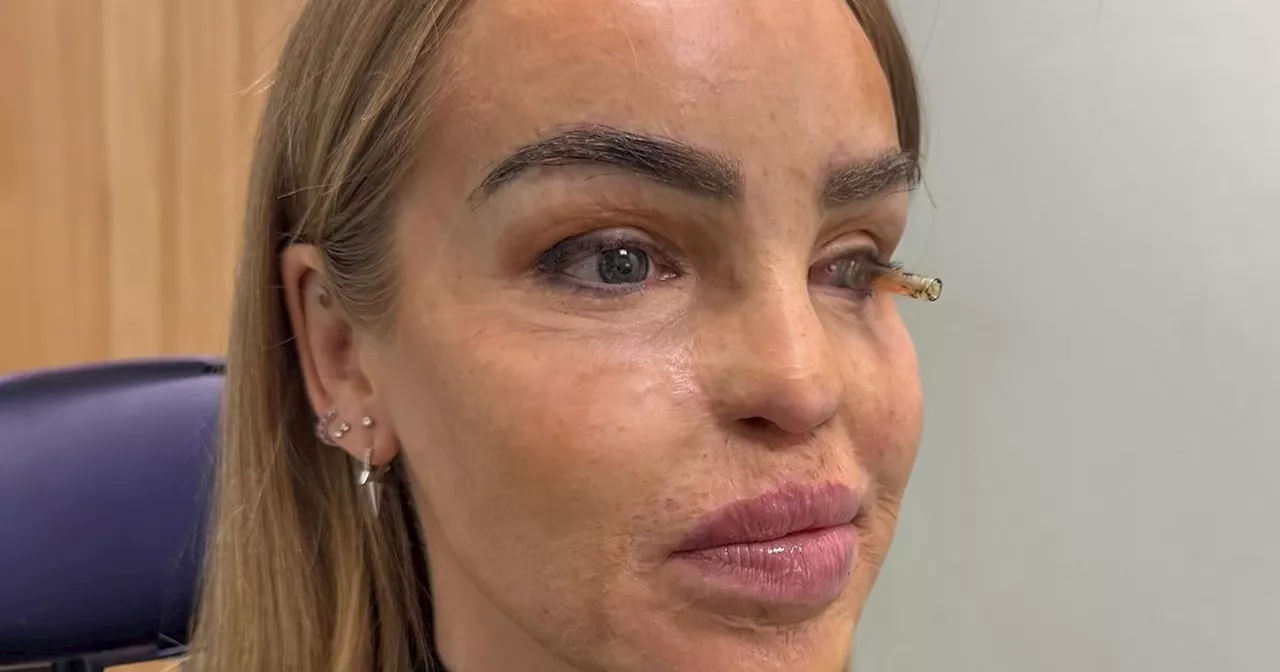 Loose Women's Katie Piper shares brave eye surgery 'battle' update in new video