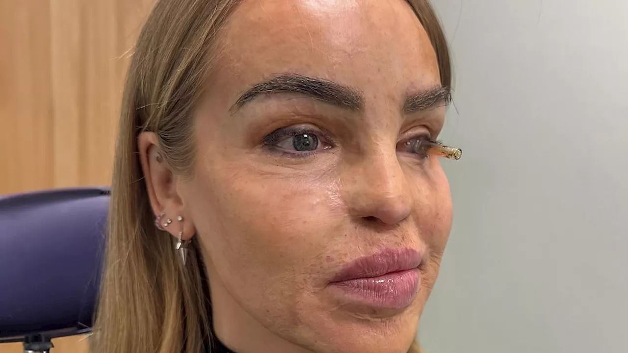 Katie Piper shares emotional health update after undergoing eye surgery: 'I've reached the end of...