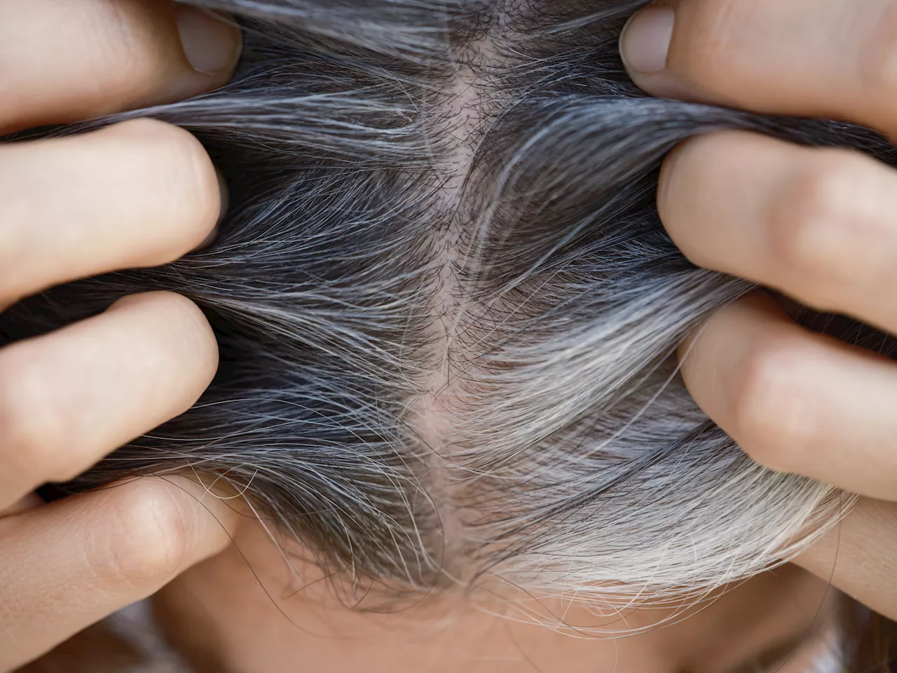 Why Millennials and Gen Z Are Going Gray Early, According to Experts