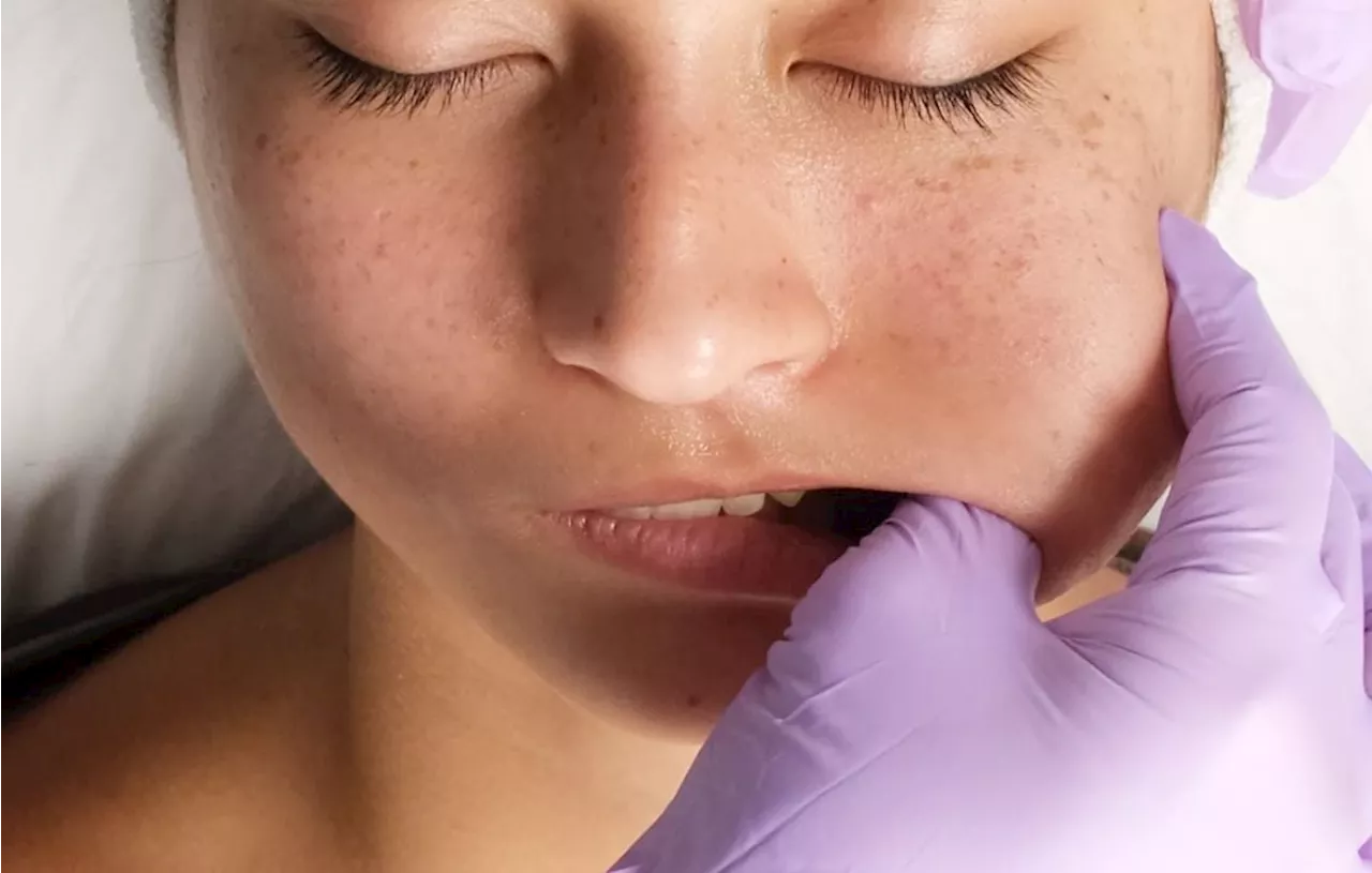 Massage Intrabuccal : Une Nouvelle Technique de Beauté