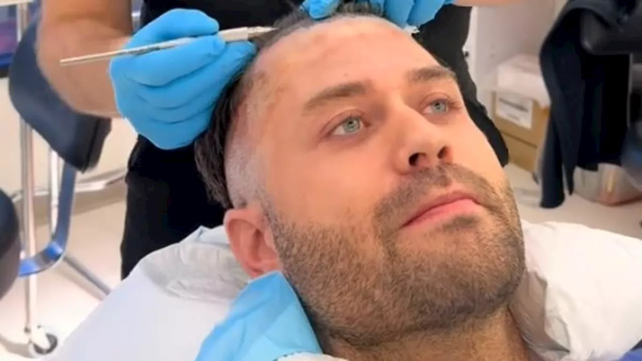 Secret Lives of Mormon Wives star Dakota Mortensen, 31, documents 'crazy' hair transplant journey