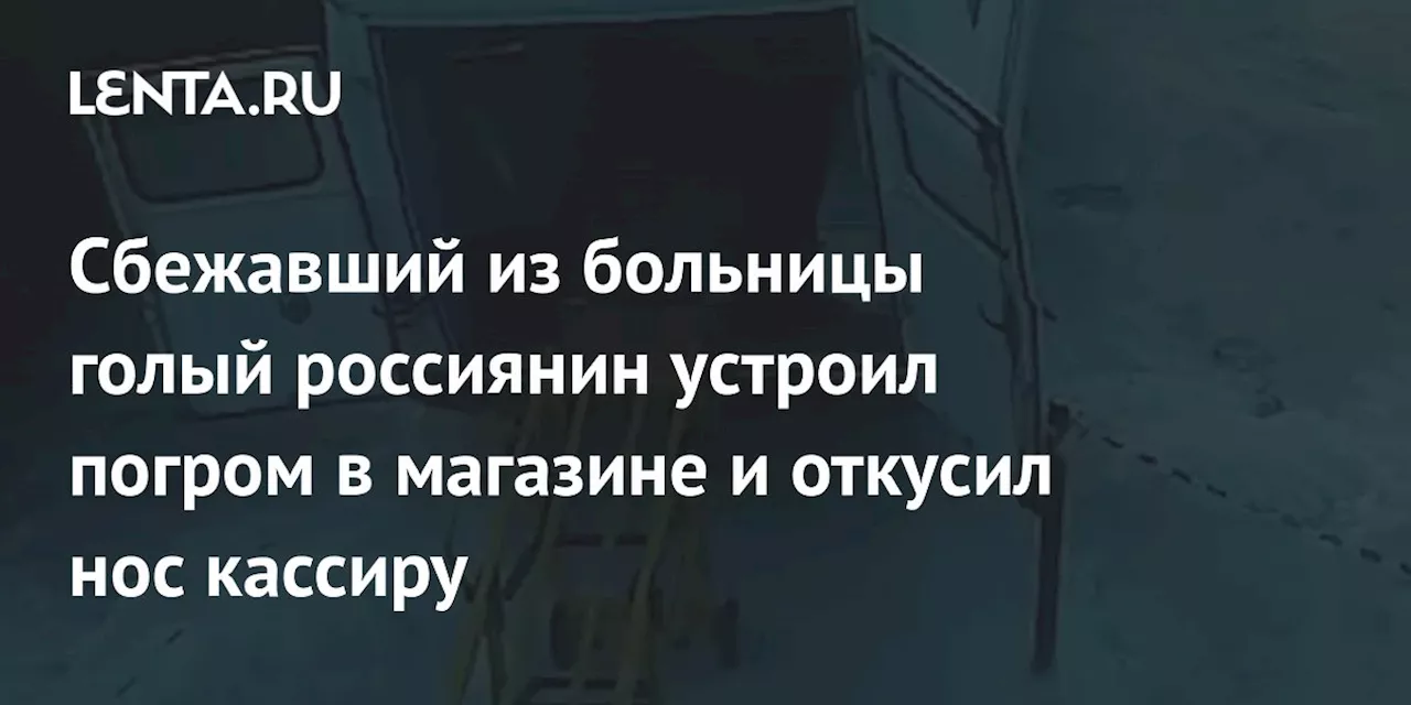 Сбежавший из больницы голый россиянин устроил погром в магазине и откусил нос кассиру