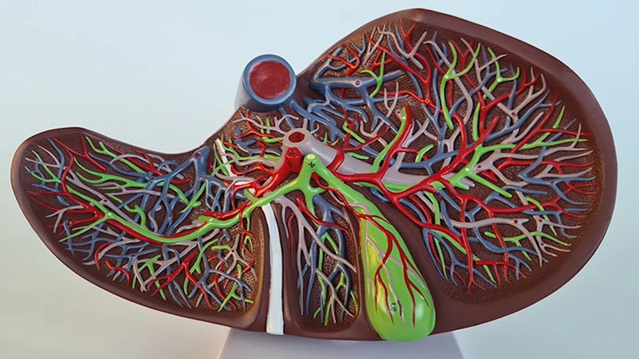 How to Manage Portal Hypertension and Varices in Cirrhosis: Best Practices