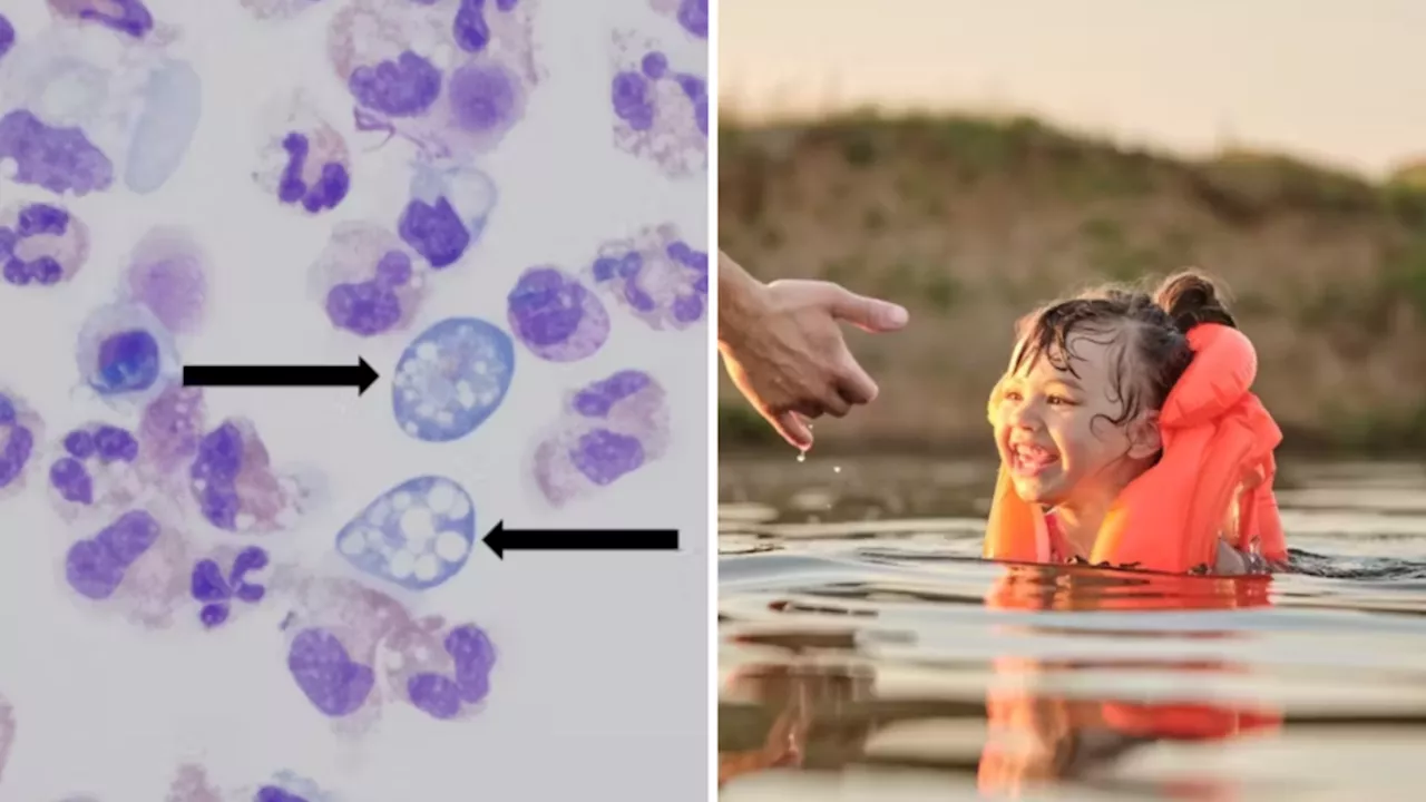 Brain-Eating Amoeba: A Hidden Danger in Freshwater Swimming Holes