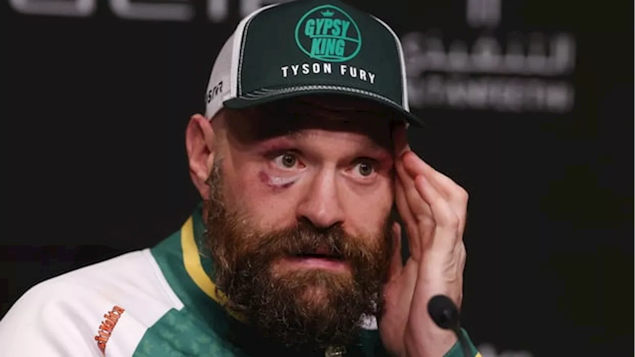 Tyson Fury Announces Retirement From Boxing Again