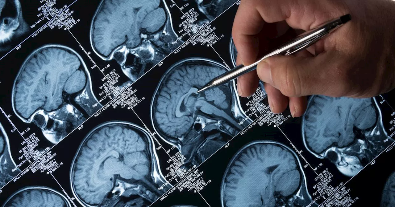 Delayed Brain Maturation Linked to Disordered Eating in Young Adults