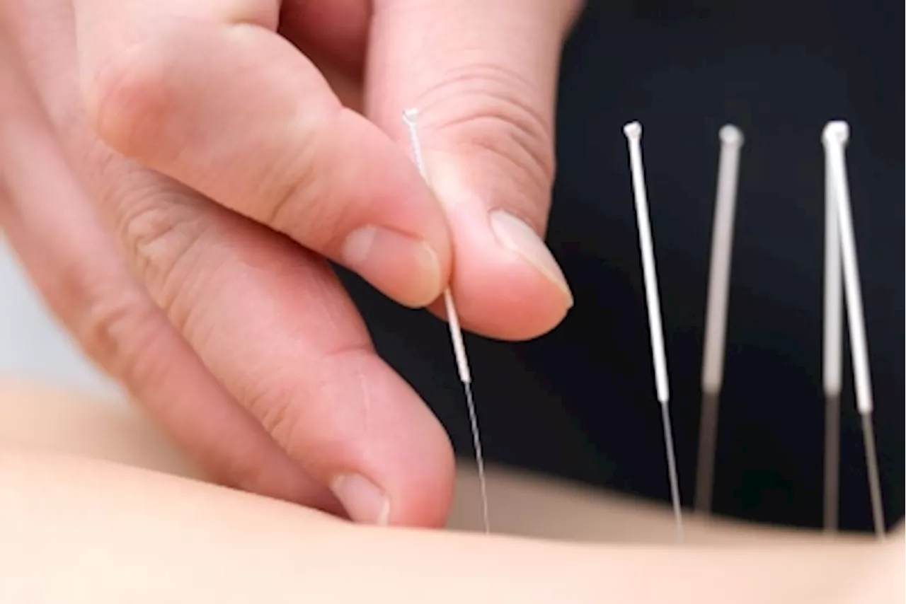 TCM Practitioner Suspended for Leaving Acupuncture Needles in Patient