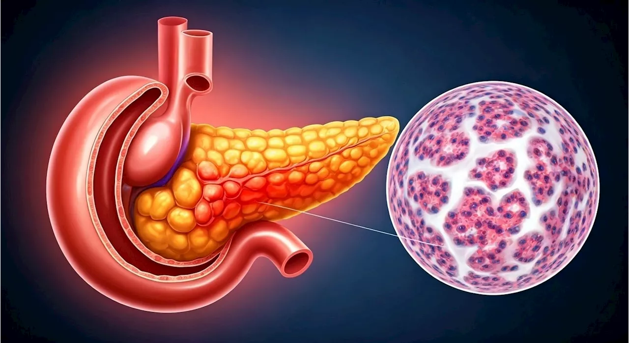 Pancreatic cancer insights: How pORG classifications predict survival and guide treatment