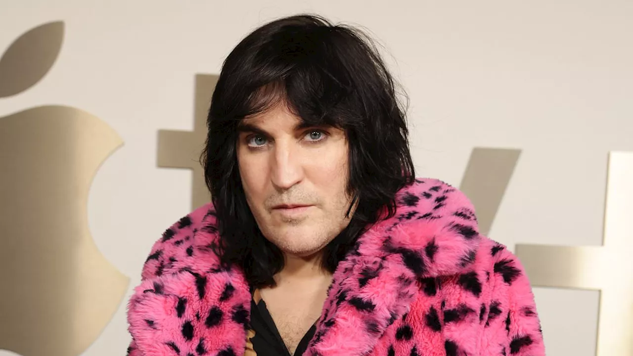 Noel Fielding's Dick Turpin Comedy Axed Mid-Production