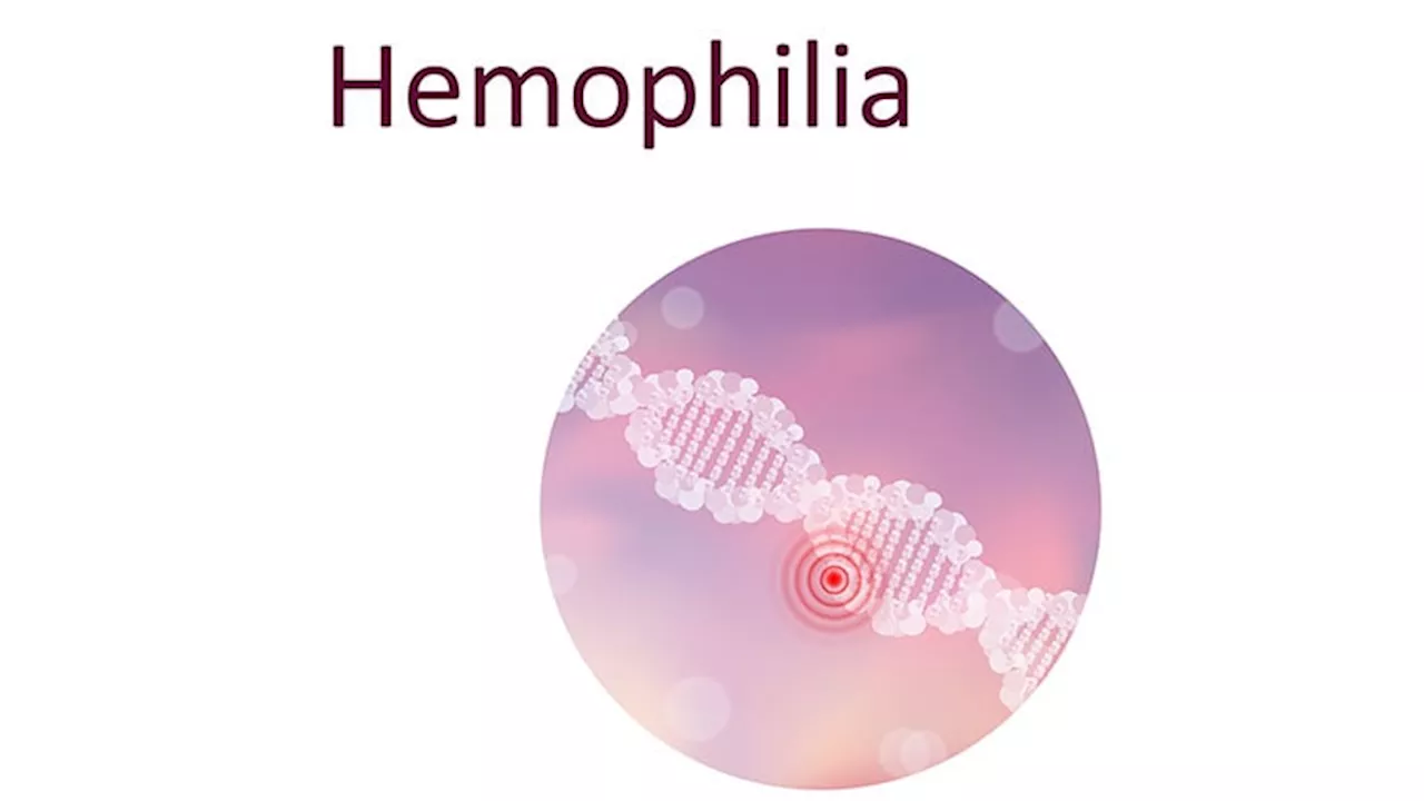 Gene Therapy's Slow Rollout for Hemophilia