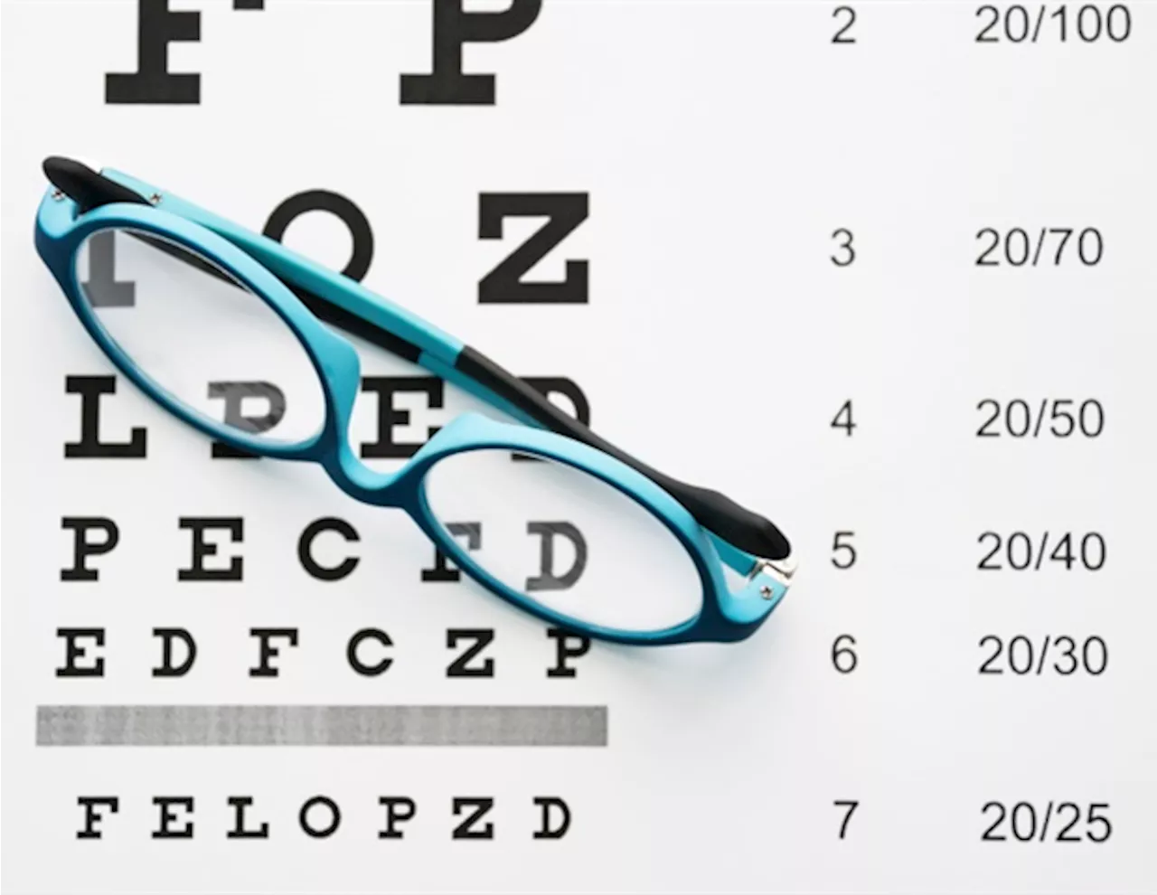 Study finds lasting benefits of multifocal contact lenses in slowing myopia